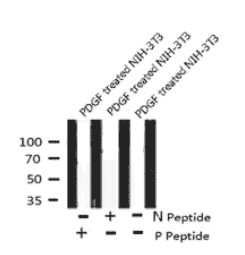 FGFR4 (Phospho- Tyr754) Antibody - Click Image to Close